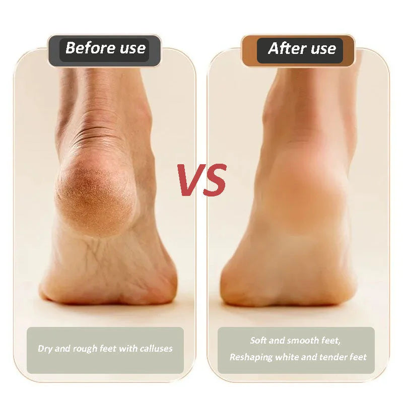 2025 Nuevo dispositivo USB recargable para reparar y afilar los pies