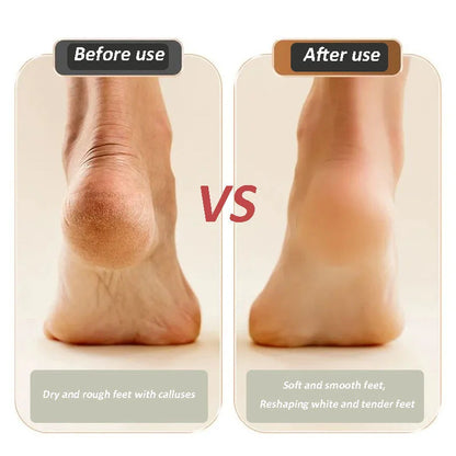 2025 Nuevo dispositivo USB recargable para reparar y afilar los pies