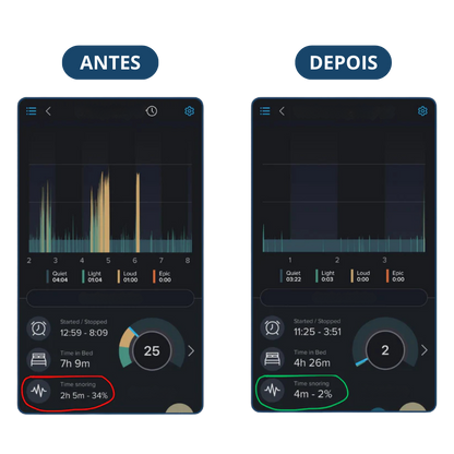 Sonar+ Benevita® - Protetor Bucal Anti-Ronco - OFERTA BLACK ESTENDIDA🔥 LEVE MAIS PAGANDO MENOS (ÚLTIMO DIA)