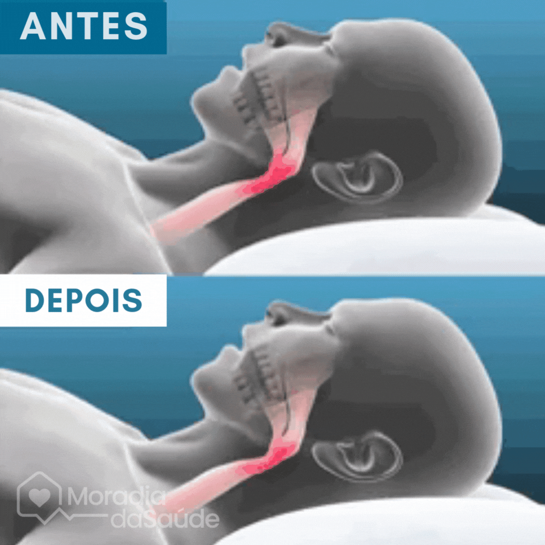 Znorex® Protetor Bucal Anti-Ronco - 60% de desconto (SOMENTE AQUI)